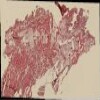33 heart GA17.jp2.tif thumbnail