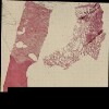 40_lung_GA17.tif thumbnail