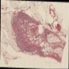 41 inguinal LN GA17.jp2.tif thumbnail