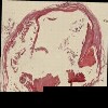 47 aorta ima GA17.tif thumbnail