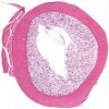 Rib Decalcified_IOWA.svs.tif thumbnail