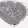 Lymph Node Silver_IOWA.svs.tif thumbnail