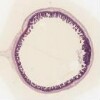 34-81446_015 Ileum Peyer.svs.tif thumbnail