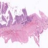 AnoRectal Junction_IOWA.svs.tif thumbnail
