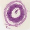 Appendix_IOWA.svs.tif thumbnail