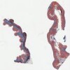 Colon-tenia coli 20x.svs.tif thumbnail