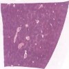 Liver_IOWA.svs.tif thumbnail