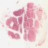 Michigan 185-2_HISTO_40X.svs.tif thumbnail