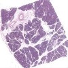 Pancreas2_IOWA.svs.tif thumbnail