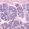 Parotid Gland_IOWA.svs.tif thumbnail
