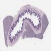 UCSF-UofMichigan269_40X.svs.tif thumbnail