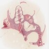 Michigan EAR-2_HISTO_40X.svs.tif thumbnail