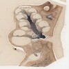 Michigan Ear-4_HISTO_40X.svs.tif thumbnail