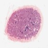 37-81449_247 Pineal gland.svs.tif thumbnail