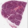 Michigan 188_HISTO_20X.svs.tif thumbnail