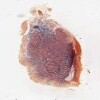 Michigan 218-2_HISTO_20X.svs.tif thumbnail