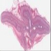 Michigan 230_HISTO_20X.svs.tif thumbnail
