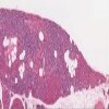 Michigan target_organ_4.svs.tif thumbnail