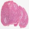 Thyroid.svs.tif thumbnail