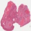 Michigan 234-1_HISTO_40X.svs.tif thumbnail