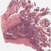Michigan 240-1_HISTO_40X.svs.tif thumbnail