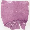 Michigan 245-1_HISTO_40X.svs.tif thumbnail