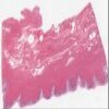Michigan 250-1_HISTO_20X.svs.tif thumbnail