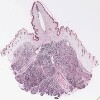 Nipple, Lactating Breast.svs.tif thumbnail