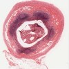 175_HISTO_40X.svs.tif thumbnail