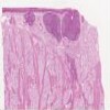 Lingual Tonsil_IOWA.svs.tif thumbnail
