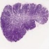 Lymph Node_IOWA.svs.tif thumbnail