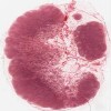 Michigan 027_HISTO_40X.svs.tif thumbnail