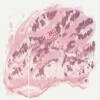 Michigan 141_HISTO_40X.svs.tif thumbnail
