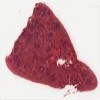 Michigan 147_HISTO_40X.svs.tif thumbnail