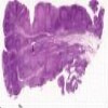 Pharyngeal Tonsil_IOWA.svs.tif thumbnail