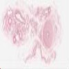 70-81522_278 Vas deferens.svs.tif thumbnail