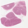 98-9796_SeminalVesicle.svs.tif thumbnail