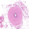Ductus Deferens_IOWA.svs.tif thumbnail