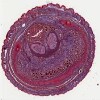 Foetal_penis.svs.tif thumbnail