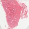 Prostate.svs.tif thumbnail
