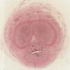 _201 Penis-infant 20x.svs.tif thumbnail
