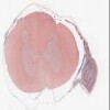 Michigan 065-1_HISTO_20X.svs.tif thumbnail