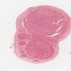 Michigan 068_HISTO_40X.svs.tif thumbnail