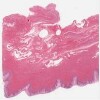 Michigan 250-1_HISTO_40X.svs.tif thumbnail