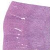 Kidney Intralobular_IOWA.svs.tif thumbnail