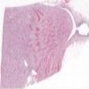 Kidney_IOWA.svs.tif thumbnail