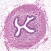 Ureter_IOWA.svs.tif thumbnail