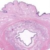 Urethra Penile2_IOWA (1).svs.tif thumbnail