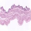 Urinary Bladder1_IOWA.svs.tif thumbnail