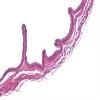 Urinary Bladder2_IOWA.svs.tif thumbnail